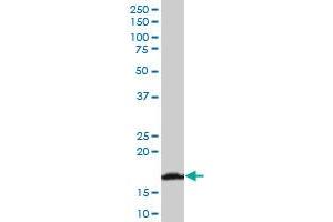 RPS17 polyclonal antibody (A03), Lot # 060529JCS1 Western Blot analysis of RPS17 expression in Jurkat .