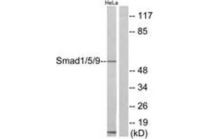Western blot analysis of extracts from HeLa cells, using Smad1/5/9 Antibody.
