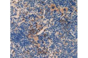 Used in DAB staining on fromalin fixed paraffin- embedded spleen tissue (SMAD6 anticorps  (AA 171-441))
