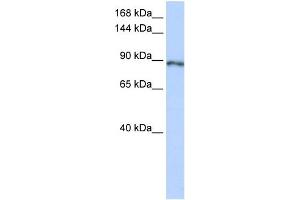 WB Suggested Anti-SOLH Antibody Titration:  0. (Calpain 15/SOLH anticorps  (Middle Region))