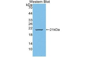 Detection of Recombinant WNT11, Human using Polyclonal Antibody to Wingless Type MMTV Integration Site Family, Member 11 (WNT11)