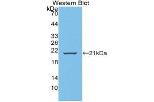Detection of Recombinant WNT11, Human using Polyclonal Antibody to Wingless Type MMTV Integration Site Family, Member 11 (WNT11)