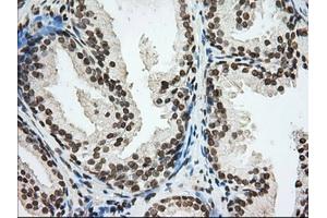 Immunohistochemical staining of paraffin-embedded Human Kidney tissue using anti-CYP1A2 mouse monoclonal antibody. (CYP1A2 anticorps)