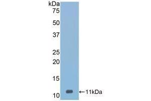 Western blot analysis of recombinant Mouse Vaspin.