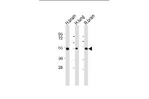 All lanes : Anti-DUSP6 Antibody (Center) at 1:2000 dilution Lane 1: Human brain lysate Lane 2: Human lung lysate Lane 3: Rat brain lysate Lysates/proteins at 20 μg per lane.
