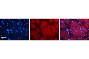 Rabbit Anti-Hdac6 Antibody    Formalin Fixed Paraffin Embedded Tissue: Human Adult heart  Observed Staining: Cytoplasmic Primary Antibody Concentration: 1:600 Secondary Antibody: Donkey anti-Rabbit-Cy2/3 Secondary Antibody Concentration: 1:200 Magnification: 20X Exposure Time: 0. (HDAC6 anticorps  (C-Term))