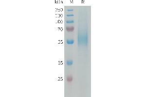 Human Protein, His Tag on SDS-PAGE under reducing condition.