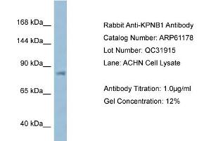 Western Blotting (WB) image for anti-Karyopherin (Importin) beta 1 (KPNB1) (N-Term) antibody (ABIN2788708) (KPNB1 anticorps  (N-Term))
