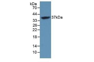 Detection of Recombinant FOSL1, Mouse using Polyclonal Antibody to FOS Like Antigen 1 (FOSL1) (FOSL1 anticorps  (AA 1-273))
