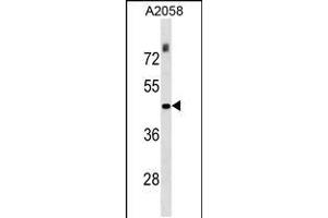 Western blot analysis in A2058 cell line lysates (35ug/lane). (THO Complex 3 anticorps  (N-Term))