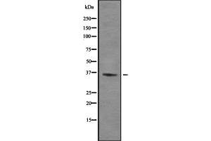 Western blot analysis of TIS11B using Jurkat whole cell lysates (ZFP36L1 anticorps  (Internal Region))
