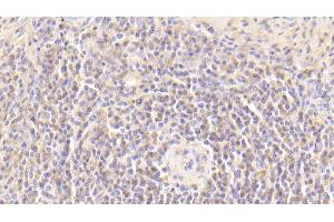 Detection of VTCN1 in Human Spleen Tissue using Polyclonal Antibody to V-Set Domain Containing T-Cell Activation Inhibitor 1 (VTCN1)