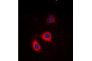 Immunofluorescent analysis of Alpha-adducin (pS726/713) staining in HeLa cells. (alpha Adducin anticorps  (C-Term, pSer713, pSer726))