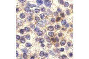 Immunohistochemistry of CX3CR1 in human spleen cells with CX3CR1 antibody at 10 μg/ml.