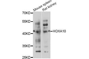 Western blot analysis of extracts of various cell lines, using HOXA10 antibody. (HOXA10 anticorps)