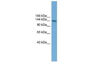 DCC antibody used at 1 ug/ml to detect target protein. (DCC anticorps  (Middle Region))