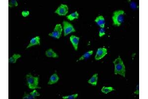 Immunofluorescence staining of SH-SY5Y cells with ABIN7153973 at 1:50, counter-stained with DAPI.