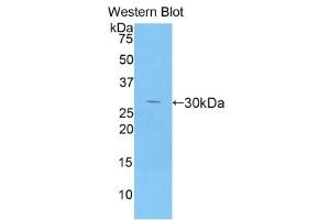 WB of Protein Standard: different control antibodies against Highly purified E.