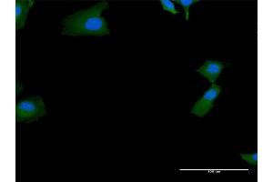 Immunofluorescence of purified MaxPab antibody to SKIV2L on HeLa cell. (SKIV2L anticorps  (AA 1-1246))