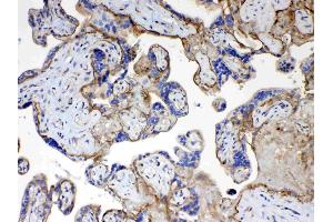 IHC analysis of CD151 using anti- CD151 antibody . (CD151 anticorps  (AA 113-175))
