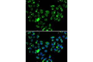 Immunofluorescence analysis of  cells using C antibody (ABIN6127550, ABIN6137939, ABIN6137940 and ABIN6222956).