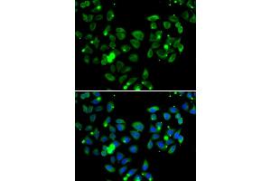 Immunofluorescence analysis of  cells using C antibody (ABIN6127550, ABIN6137939, ABIN6137940 and ABIN6222956). (CARD11 anticorps  (AA 985-1154))