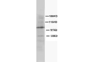 Anti-Cullin 4B antibody, Western blotting WB: Rat Lung Tissue Lysate (Cullin 4B anticorps  (C-Term))