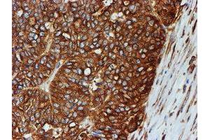 Image no. 7 for anti-Tubulin beta 4a (TUBB4A) antibody (ABIN1501579)