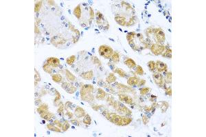 Immunohistochemistry of paraffin-embedded human gastric using RPS2 antibody at dilution of 1:100 (x40 lens). (RPS2 anticorps)