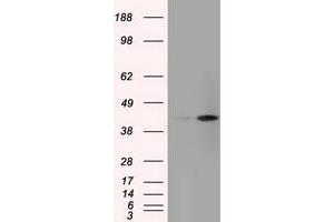 Image no. 6 for anti-Acetyl-CoA Acetyltransferase 2 (ACAT2) antibody (ABIN1496403) (ACAT2 anticorps)