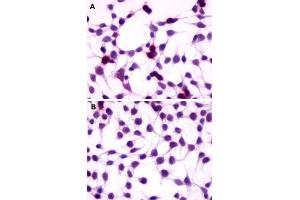 Immunocytochemistry (ICC) staining of HEK293 human embryonic kidney cells transfected (A) or untransfected (B) with GPRC5A. (GPRC5A anticorps  (Extracellular Domain))