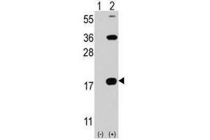 Image no. 1 for anti-CD247 Molecule (CD247) (C-Term) antibody (ABIN356886)