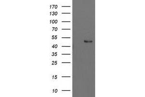 Western Blotting (WB) image for anti-Pre-B-Cell Leukemia Homeobox Protein 1 (PBX1) antibody (ABIN1500044) (PBX1 anticorps)