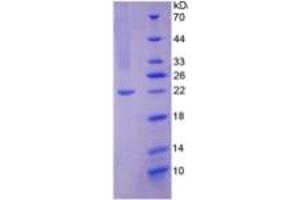 SDS-PAGE of Protein Standard from the Kit  (Highly purified E. (NOS2 Kit ELISA)