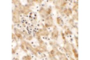 Immunohistochemistry of NKX2-8 in human liver tissue with NKX2-8 antibody at 2. (NKX2-8 anticorps  (Middle Region))