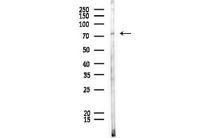 anti-Protein Kinase C, beta 1 (Pkc beta 1) (C-Term) antibody