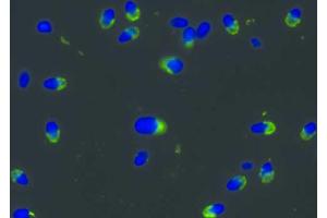 Immunocytochemistry staining of normal human sperma with anti-PRKAR2A antibody (intracellular signal in acrosomes, green), DNA visualized by DAPI (blue).
