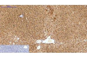 Immunohistochemistry of paraffin-embedded Human liver tissue using HAO1 Monoclonal Antibody at dilution of 1:200.