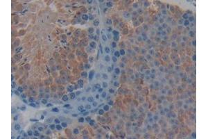 DAB staining on IHC-P; Samples: Mouse Testis Tissue