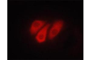 ABIN6267321 staining PC-12 cells treated with TPA by ICC/IF.