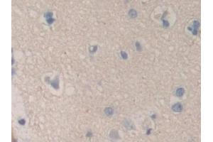 Detection of CHGB in Human Cerebrum Tissue using Polyclonal Antibody to Chromogranin B (CHGB) (CHGB anticorps  (AA 496-669))