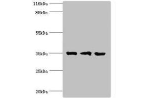 Western blot All lanes: Rab effector Noc2 antibody at 2 μg/mL Lane 1: Rat liver tissue Lane 2: K562 whole cell lysate Lane 3: A549 whole cell lysate Secondary Goat polyclonal to rabbit IgG at 1/10000 dilution Predicted band size: 35, 32 kDa Observed band size: 35 kDa (RPH3AL anticorps  (AA 1-315))