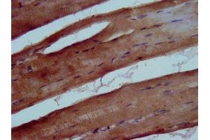 IHC image of ABIN7173357 diluted at 1:500 and staining in paraffin-embedded human skeletal muscle tissue performed on a Leica BondTM system.