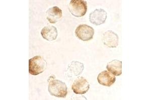 Immunocytochemistry staining of HeLa cells using AP30406PU-N IKK beta antibody at 10 μg/ml. (IKBKB anticorps  (C-Term))