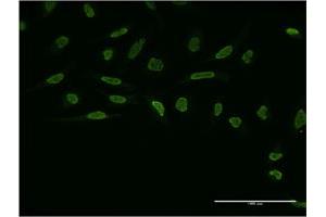 Immunofluorescence of monoclonal antibody to ZIC4 on HeLa cell.