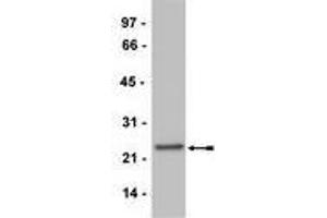 Western Blotting (WB) image for anti-CD3 (CD3) (Activation Site) antibody (ABIN400888) (CD3 anticorps  (Activation Site))