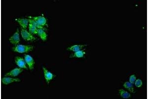 Immunofluorescent analysis of HepG2 cells using ABIN7159916 at dilution of 1:100 and Alexa Fluor 488-congugated AffiniPure Goat Anti-Rabbit IgG(H+L) (TOMM2 (AA 20-145) anticorps)