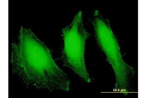 Immunofluorescence of purified MaxPab antibody to FANCA on HeLa cell.