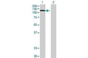 Lane 1: KSR2 transfected lysate ( 91.