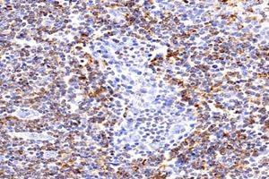 Immunohistochemistry analysis of paraffin-embedded human tonsil using,HLA-DP (ABIN7074613) at dilution of 1: 2400 (HLA-DP anticorps)
